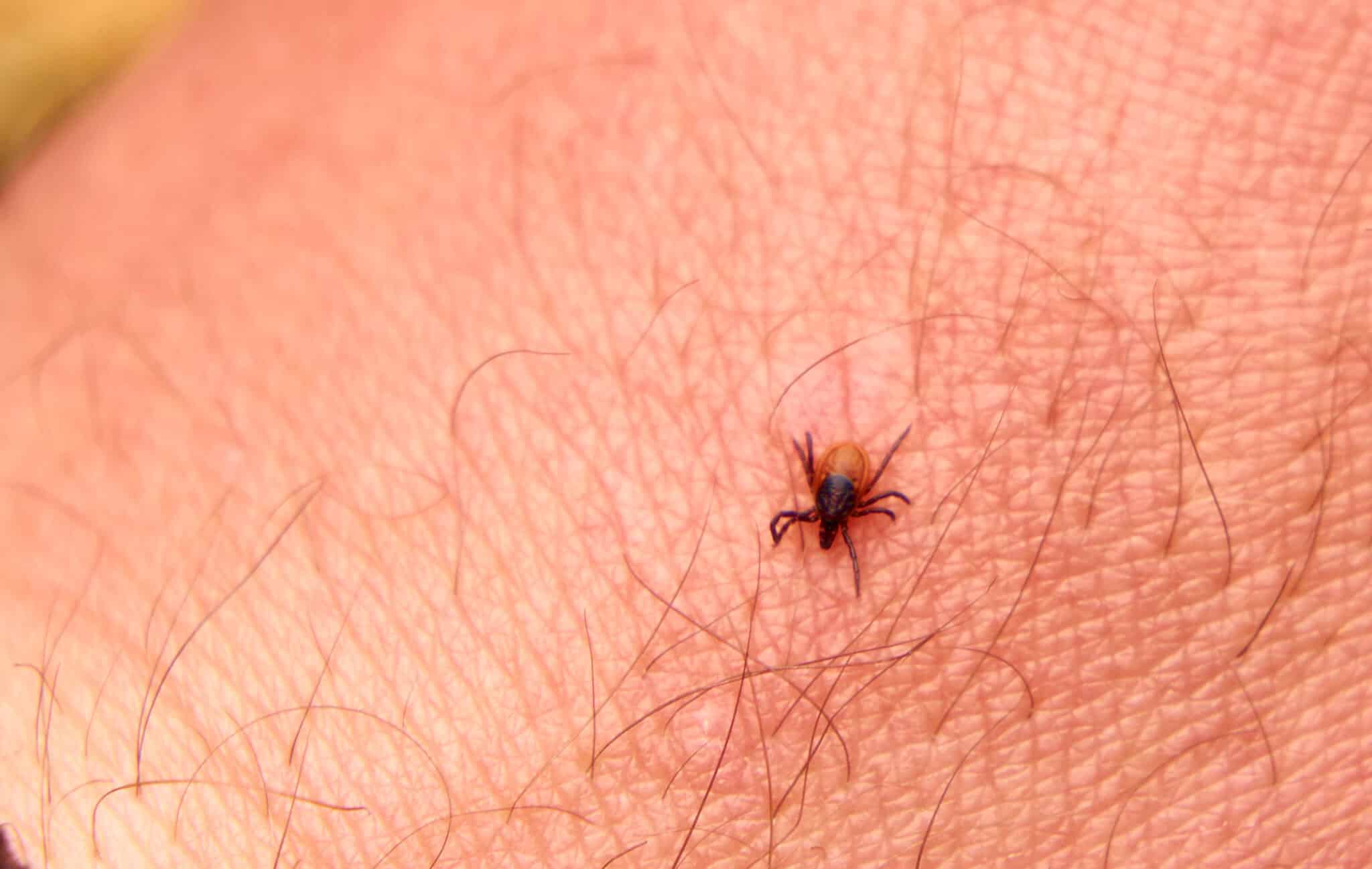 How to Get Rid of Chiggers A Detailed Guide